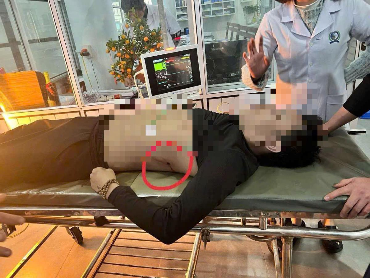 Khẩu súng được cho là nghi phạm dùng để bắn anh P.