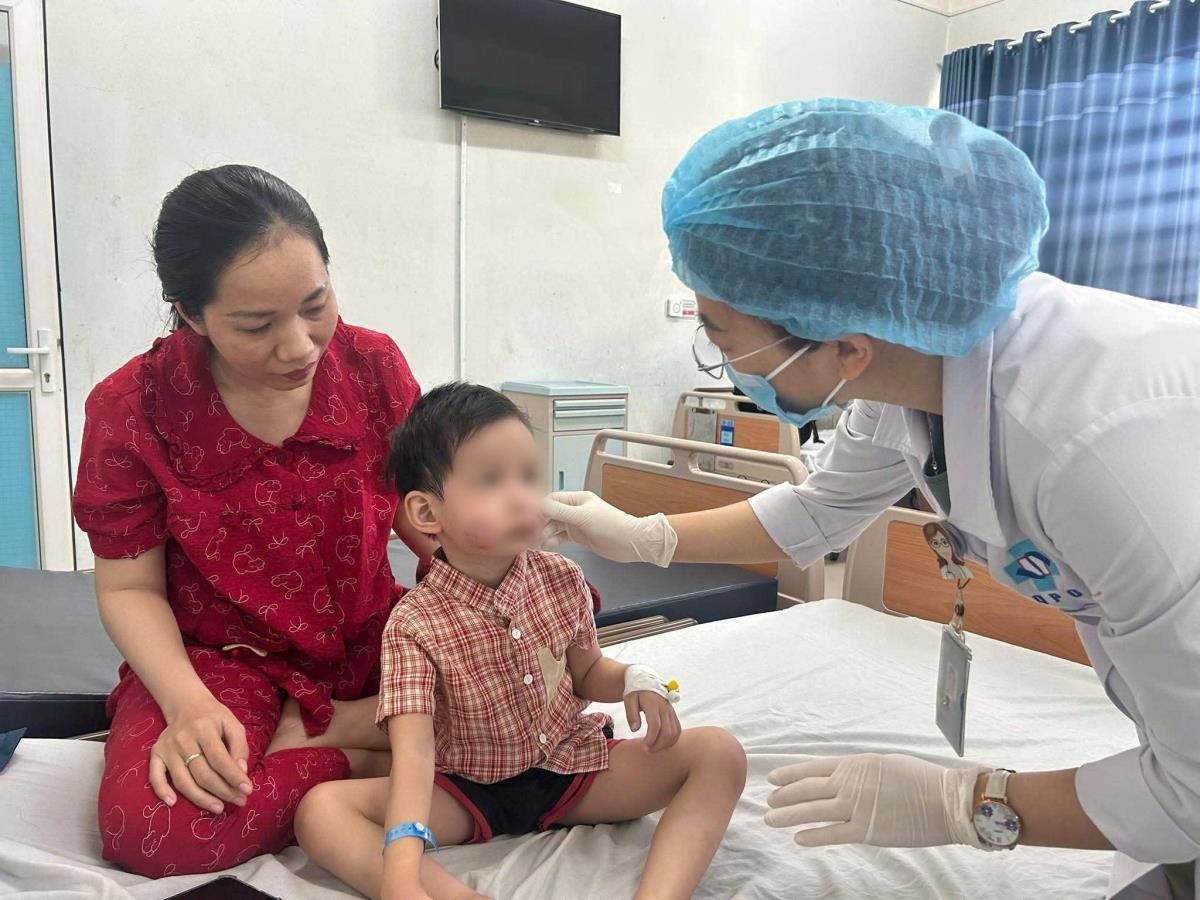 Bệnh nhi G.H được gia đình đưa đến cấp cứu trong tình trạng có nhiều vết thương vùng mặt.